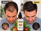 Batana Oil Fast Hair Growth for Men Women Pure Batana Oil Nourish Shiny Hair Healthy Hair Care Anti Hair Loss