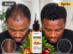 Batana Oil Fast Hair Growth for Men Women Pure Batana Oil Nourish Shiny Hair Healthy Hair Care Anti Hair Loss